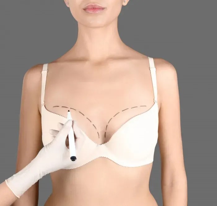 female Breast Augmentation surgery in mumbai