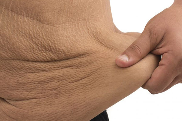 Common Problems After Bariatric Surgery