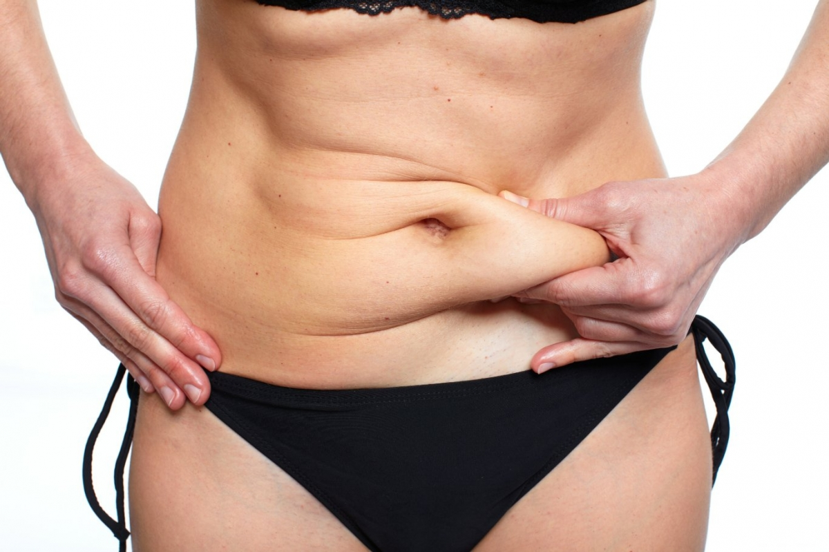 Who is Good Candidate for a Abdominoplasty or Tummy Tuck surgery in mumbai